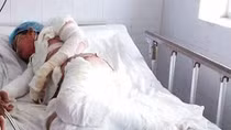 Tranh cãi tiền nợ, chồng đổ dầu đốt vợ bỏng toàn thân