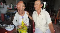 Nghị lực và lòng hiếu thảo của cô gái tật nguyền