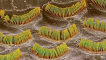 Liệu pháp virus cho người khiếm thính