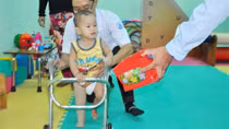 Nghẹn lòng xem ‘cháu bé văng khỏi bụng mẹ’ tập đi bằng chân giả
