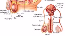 Một bệnh dễ dẫn đến vô sinh ở nam giới