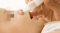 Trẻ 28 tháng tuổi nhập viện vì mẹ nhỏ nhầm cồn 90 độ vào mũi