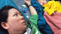 Rò khí gas, hai mẹ con bỏng nặng trong lúc nấu mì