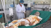 Vụ 6 người bỏng nhập viện - Nhiều khả năng do cháy nổ vì đào than thổ phỉ