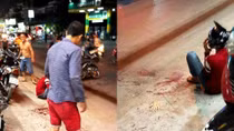 Khởi tố vụ chém người lìa bàn tay trên phố 