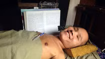 Số phận nghiệt ngã của chàng trai xin được hiến… đầu