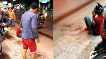 Truy xét nghi can chém lìa tay thanh niên trên phố