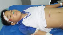 (HY HỮU) Vỡ gan vì ngã xe đạp