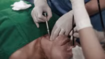 Đổ xô phẫu thuật chỉnh giọng nói để gây ấn tượng với người khác giới