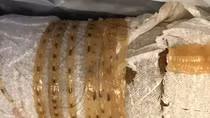 Ăn gỏi cá sushi bị nhiễm sán dây dài ... 1,68 m