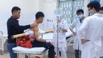 Thông tin mới nhất vụ nam thanh niên bị cây gỗ keo đâm xuyên ngực