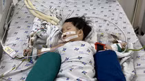 Bé gái suýt mất mạng vì hóc xương lươn