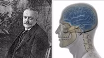 Alzheimer – Căn bệnh của thế kỷ XXI