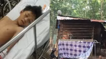 Xót xa gia cảnh em thiếu niên gặp tai nạn nghiêm trọng