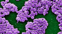 Mối đe dọa hồi sinh của virus cổ đại