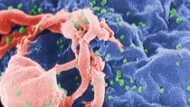 Sắp có chủng ngừa virus HIV?