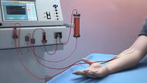 Yêu cầu các đơn vị chấn chỉnh qui trình chạy thận nhân tạo