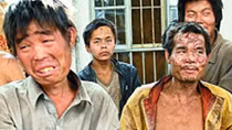 Nhiễm độc chì – Kẻ giết người thầm lặng