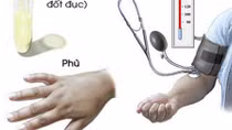 Sản giật, một căn bệnh nguy hiểm