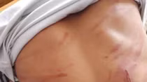 Học sinh lớp 8 ngất tại lớp vì ở nhà bị đánh dã man 