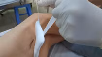 Gia tăng đột biến người nhiễm "vi khuẩn ăn thịt người"