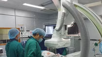 Cấy máy khử rung thành công trên bệnh nhân nhi mắc hội chứng Brugada 