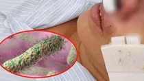 9 trường hợp ở Quảng Trị bị nhiễm vi khuẩn “ăn thịt người”
