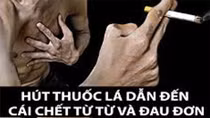 Thuốc lá – thủ phạm âm thầm phá hủy trái tim