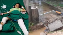 Cháu bé gãy cả hai chân vì cổng nhà văn hóa xóm đổ 