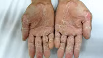 Phát hiện người mẹ mang bầu và con bị "bệnh lạ"