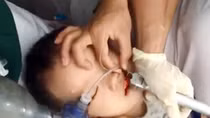 Ăn thạch rau câu, cháu bé bị hóc nguy kịch