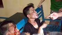 Đối tượng trộm chó giả chết tránh đòn khi bị dân vây bắt