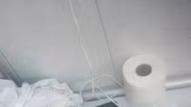 Phẫu thuật đặt stent cho bệnh nhi đầu tiên bị thủng thực quản