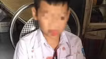 Hội Bảo vệ quyền trẻ em lên tiếng vụ phụ huynh hành hung HS lớp 1 nhập viện 