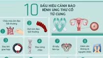 Làm gì để phòng ngừa ung thư ở phụ nữ