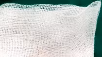 Cấp cứu lấy đinh vít và chìa khoá trong bụng bệnh nhi