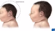 Nhiều dịch bệnh có nguy cơ bùng phát và những ứng phó mới cần đáp ứng