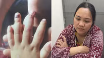 Người phụ nữ hành hạ dã man con riêng của bạn trai