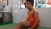 Em bé bán vé số bị đánh gãy tay, cướp 1,2 triệu đồng