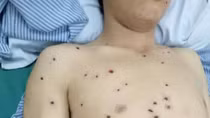 Hai thanh niên bị bắn gây thương tích