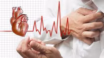 Giám đốc doanh nghiệp nước ngoài tử vong do nhồi máu cơ tim