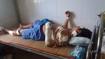 Ghen tuông, vợ cầm dao chém chồng gần 20 nhát