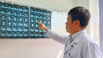 Phẫu thuật khối bướu giáp thòng trong lồng ngực