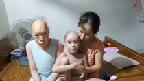 Sẻ chia nỗi buồn cùng hai em bị bệnh da khô vảy cá