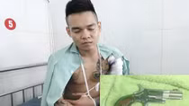 Giải quyết mâu thuẫn bằng súng, 2 người trúng đạn nhập viện cấp cứu
