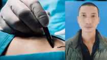 Khởi tố đối tượng mua, bán thận người