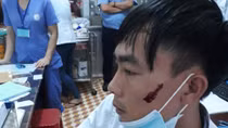 Người nhà bệnh nhân vô cớ đánh nam điều dưỡng nhập viện