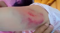 Làm rõ vụ Chánh Văn phòng Huyện uỷ đánh lái xe nhập viện