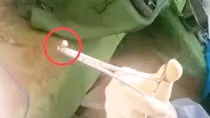 Thông tin mới nhất vụ bị bắn thủng bụng lúc 2 giờ sáng