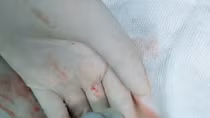 Những hiểm nguy khi dây rốn thắt nút